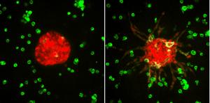 Clusters of tumor cells in the 3MIC