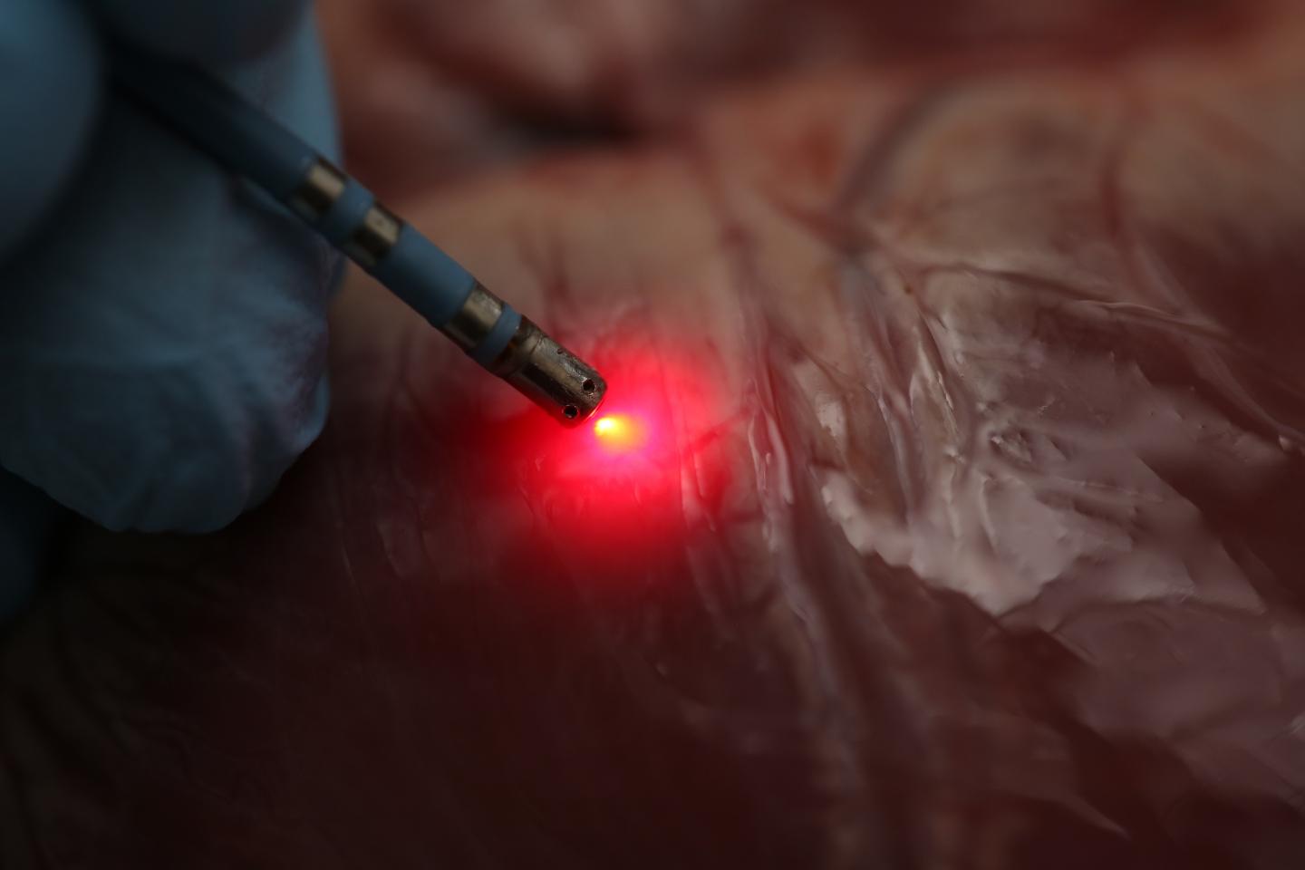 Prototype Near-Infrared Ablation Catheter