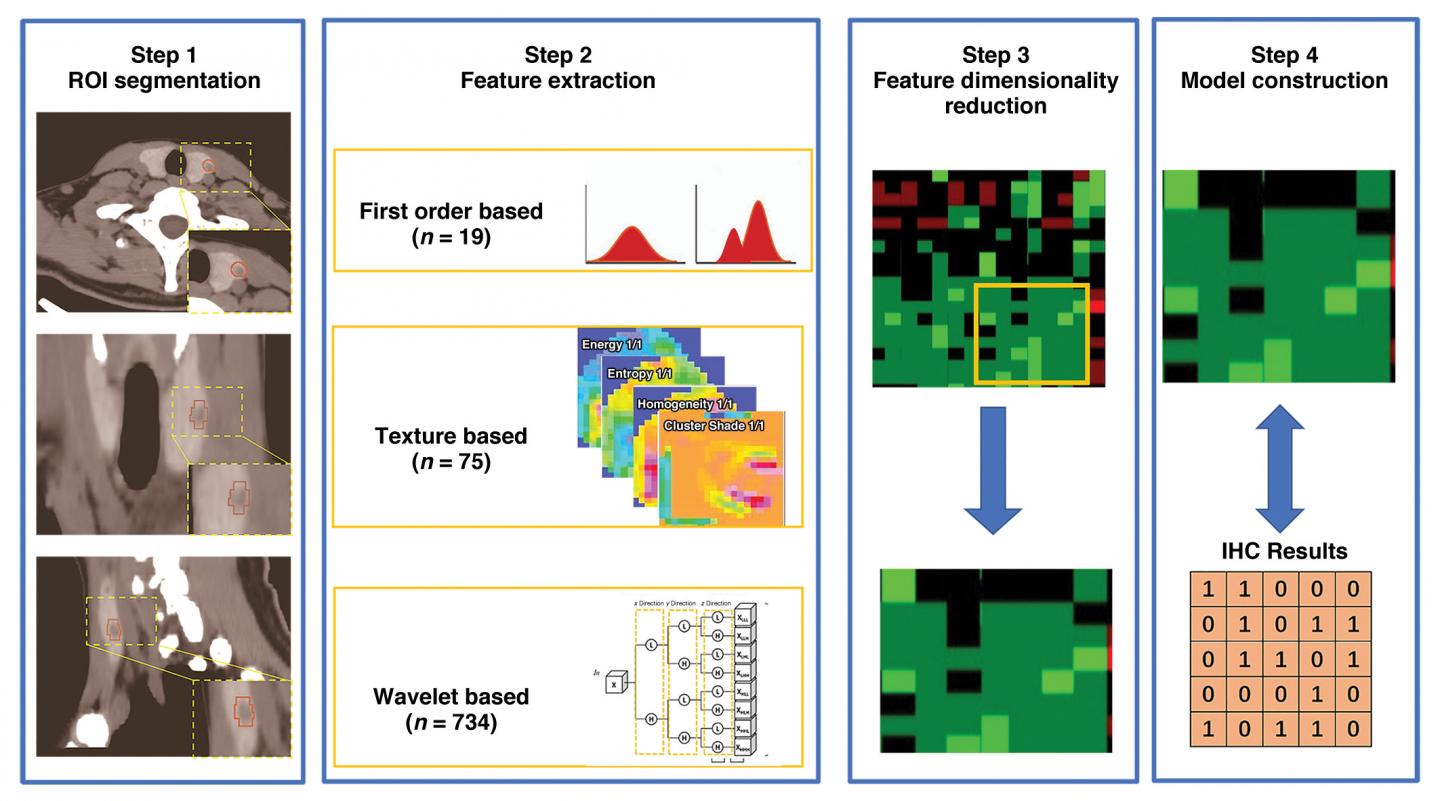 Workflow of Radiomics Analysis for IHC Indicators