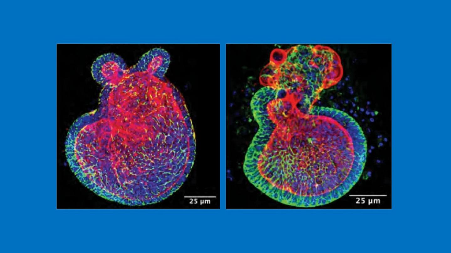 Intestinal organoids