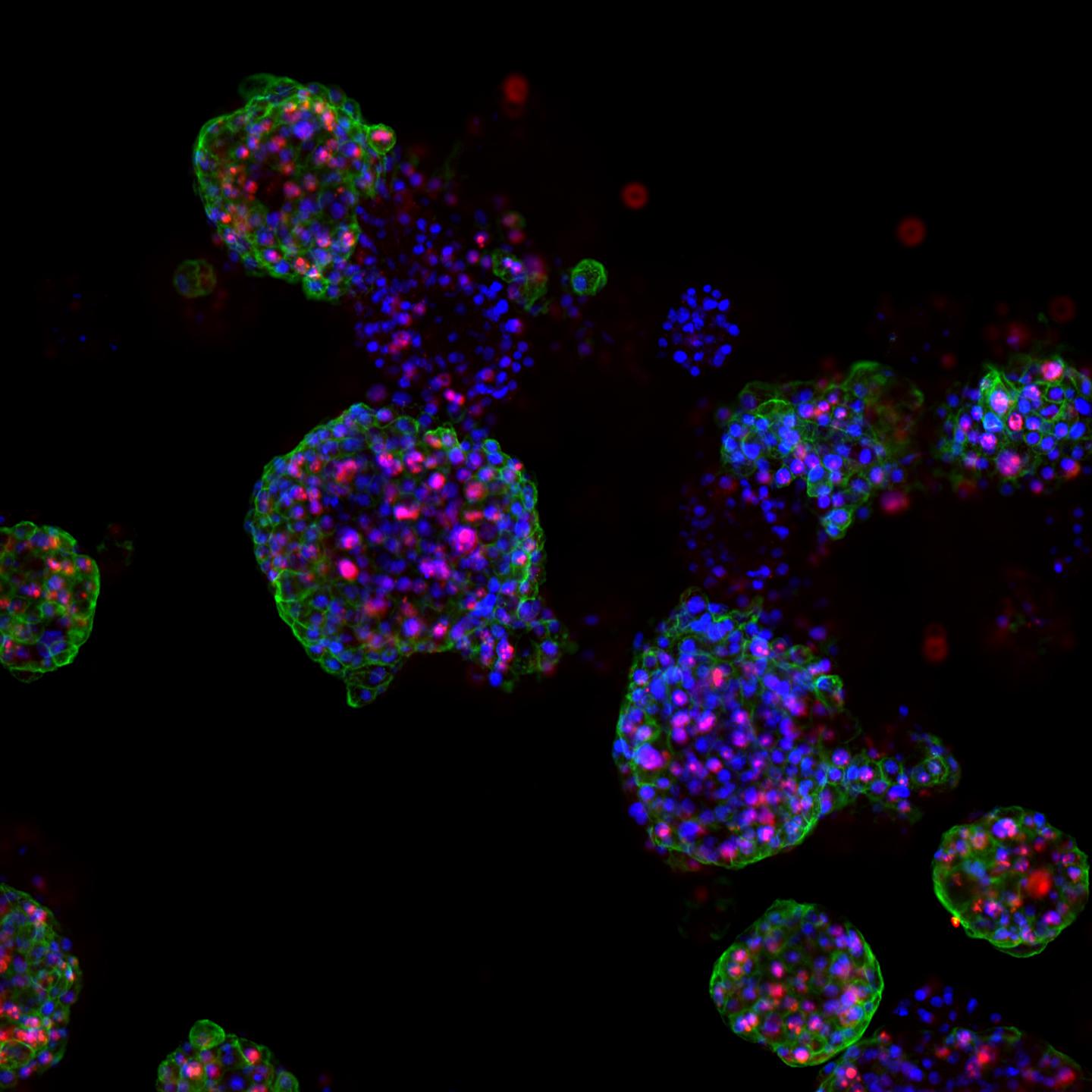 Proliferating Prostate Cancer Organoids