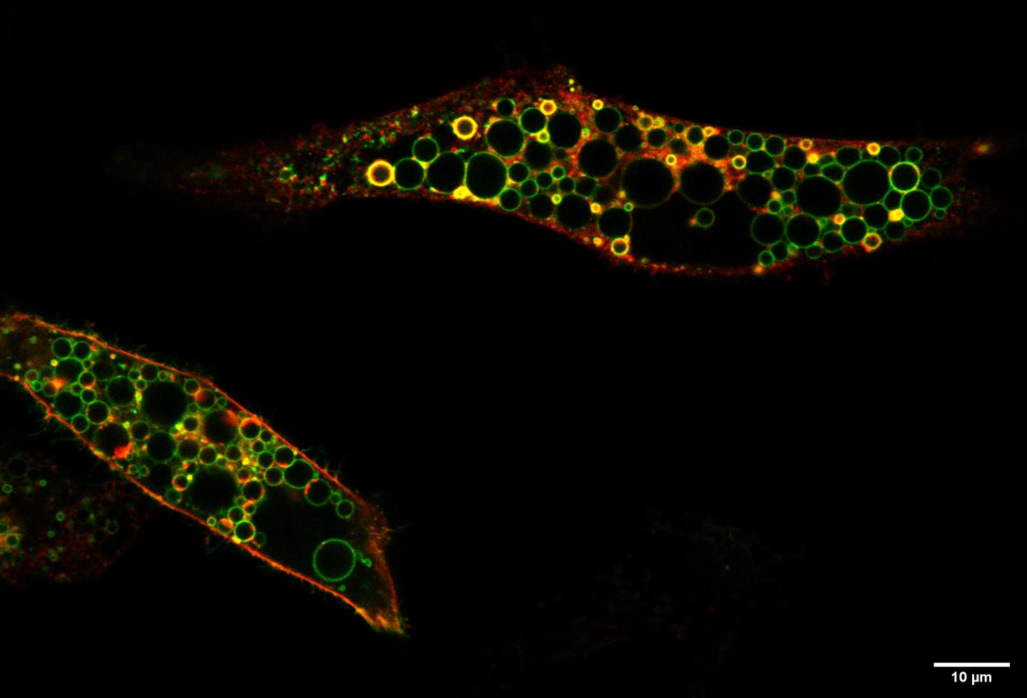 Image of two cells overproducing the ClC-6 transporter (red) carrying the disease-causing mutation.