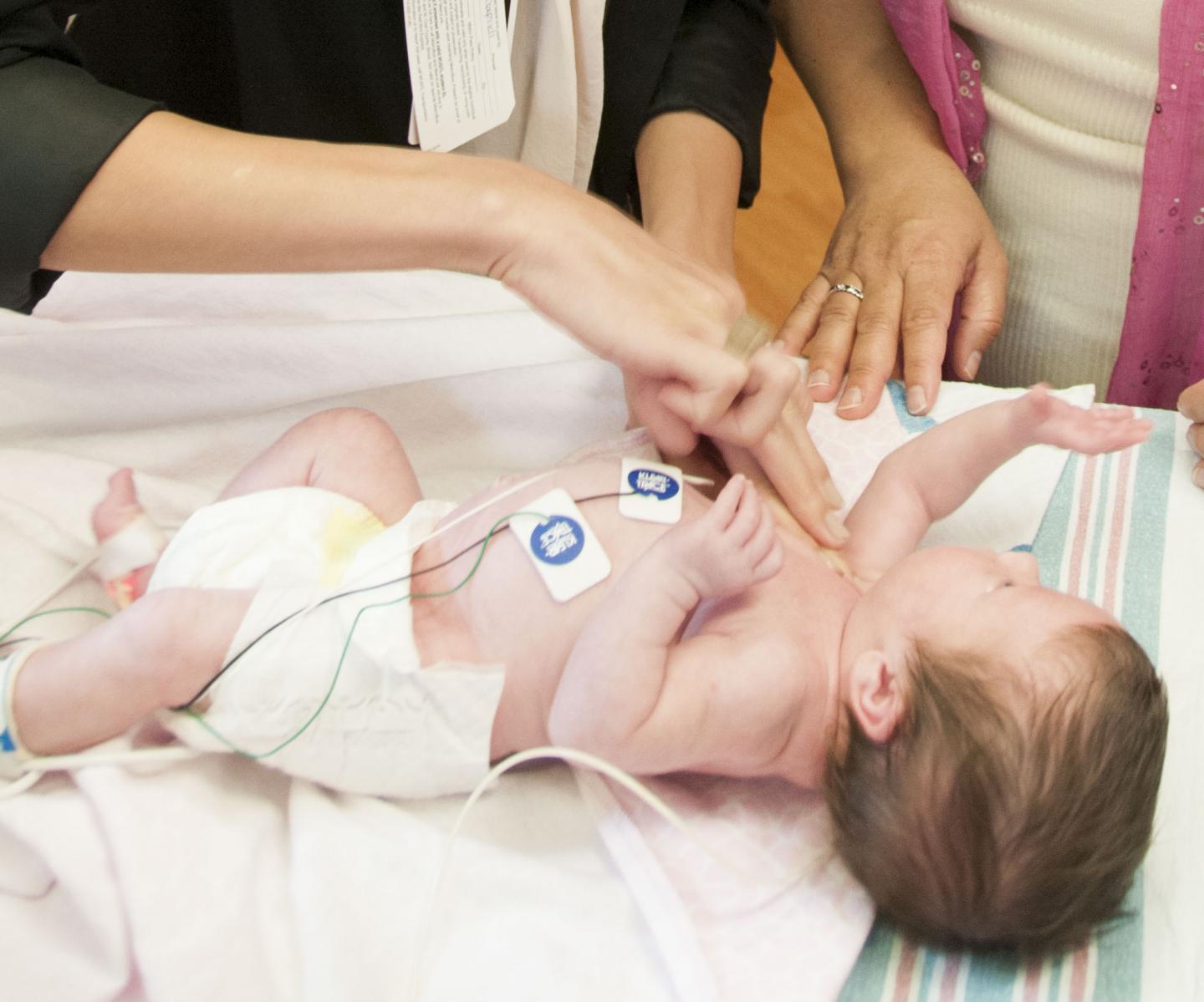 Preemies at High Risk of Autism Don't Show Typical Signs of Disorder in Early Infancy