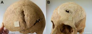 Skulls showing signs of violence.