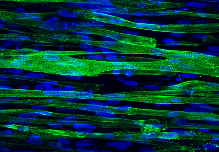 Rekonstituiertes Muskelgewebe von einem Spender mit Duchenne-Muskeldystrophie. Die Zellkerne sind blau und der kontraktile Apparat ist grün.