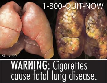 One of 9 Graphic Warnings Labels for Cigarette Packaging and Advertisements