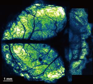 Opening a window on the brain: Innovative Nanosheet Method Revolutionizes Brain Imaging for Multi-scale and Long-Term Studies