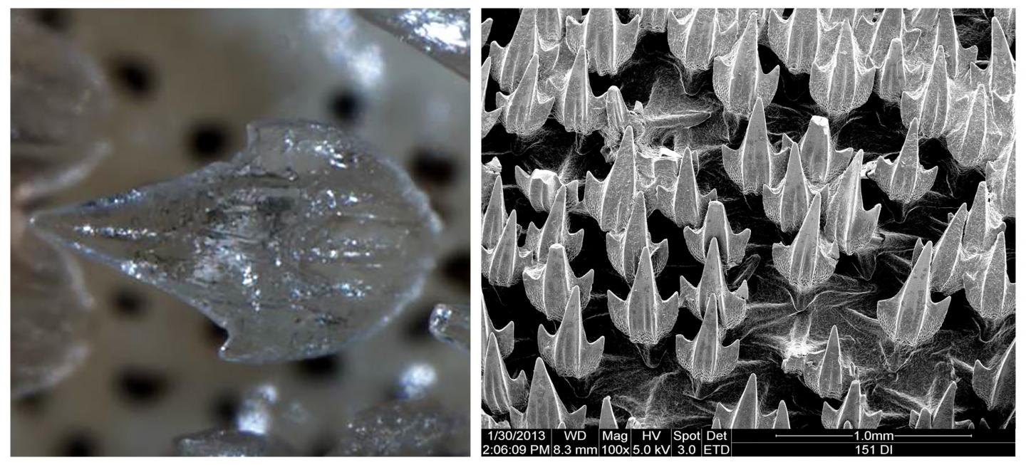 Denticles of Puffadder Shysharks