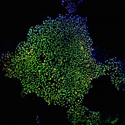 Induced Pluripotent Stem Cells