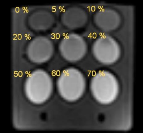 QA-DWI Phantom