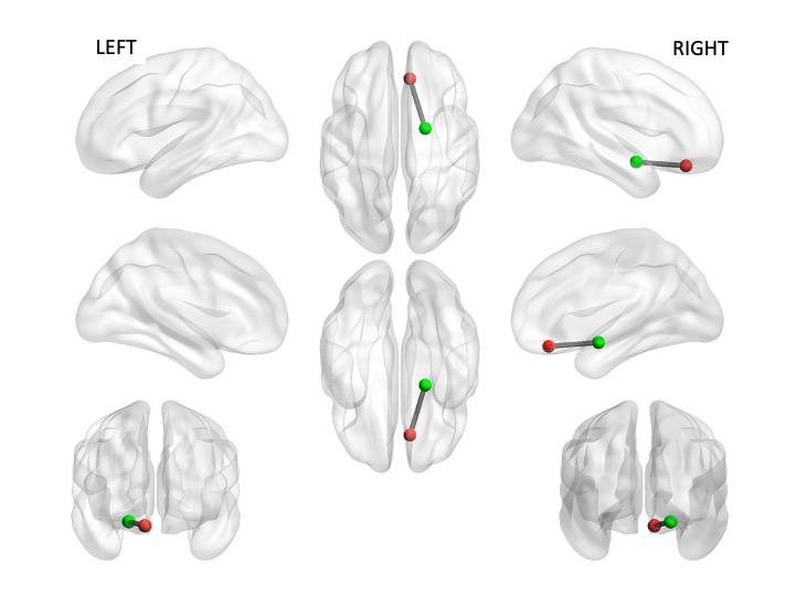 Brain Images