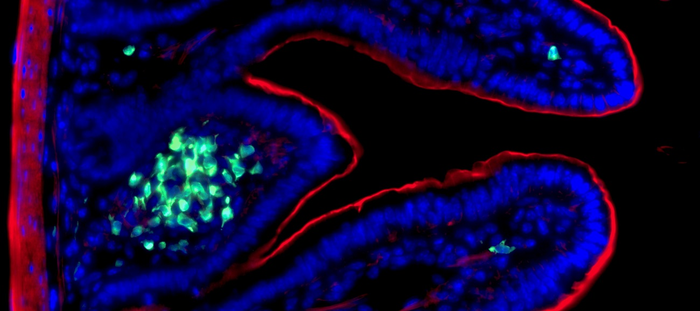 Intestinal ILC3s. Immunofluorescence staining of ILC3s (green) in the intestine (nuclei in blue and actin in red).