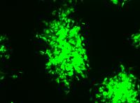 Myxoma Virus Stained with Fluorescent Dye in Rabbit Cells