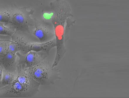 HBV-Specific T-Cell in Action