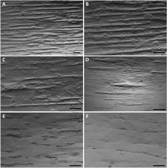 Bone surface texture