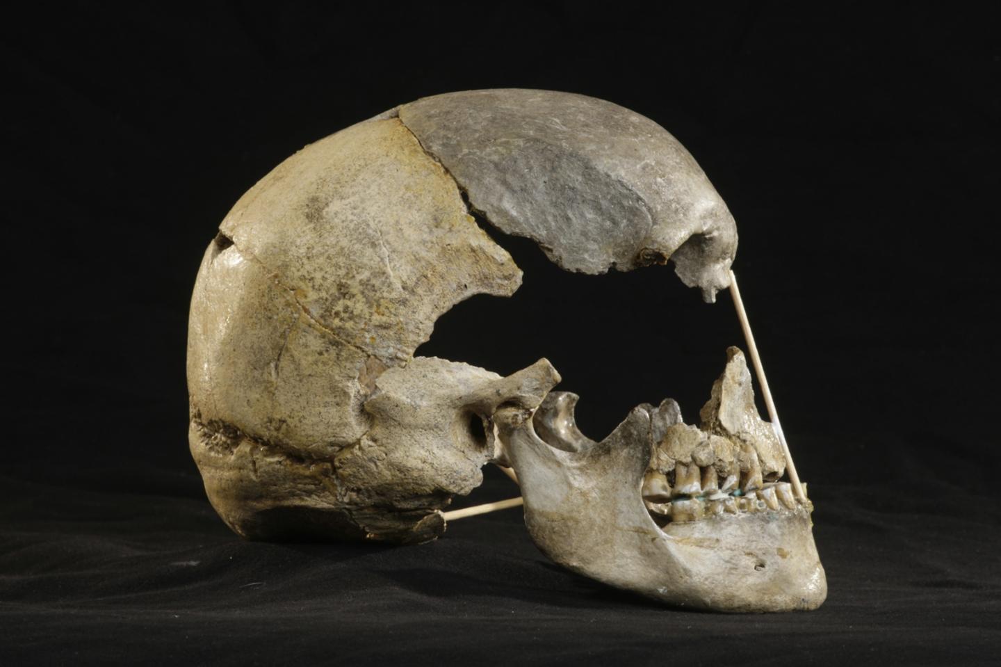 Skull lateral view