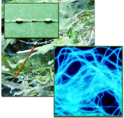 Microbial Strings of Pearls
