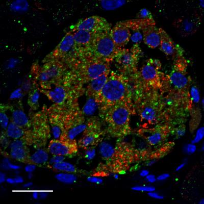 Taste Receptors in Pancreatic Beta Cells