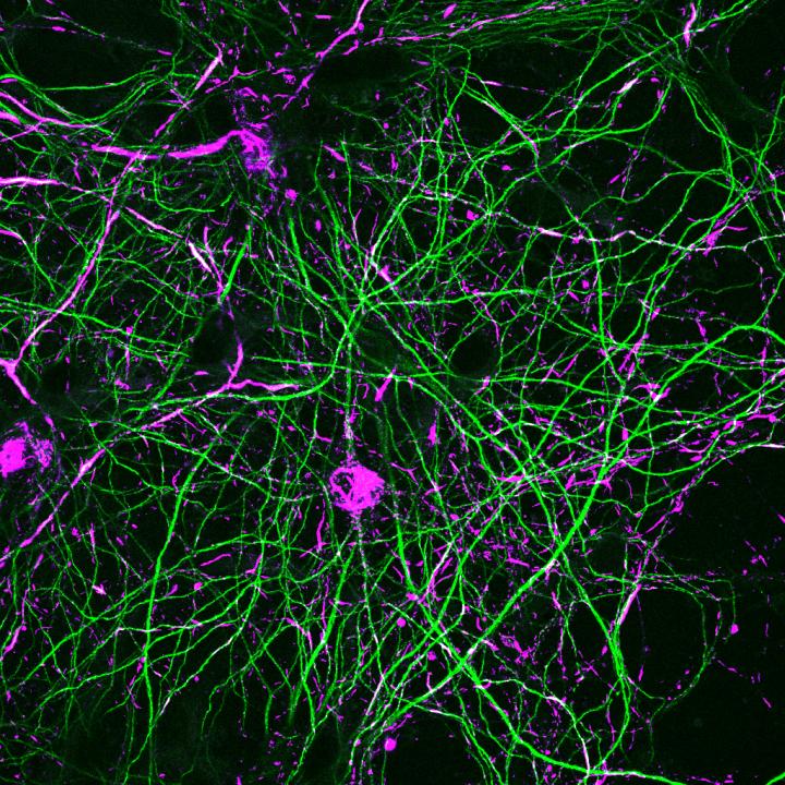 Stained Neurons