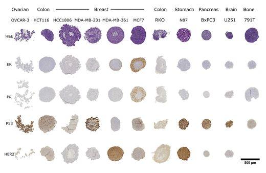 Spheroid Arrays from 11 Different Cell Lines Stained with Different Markers