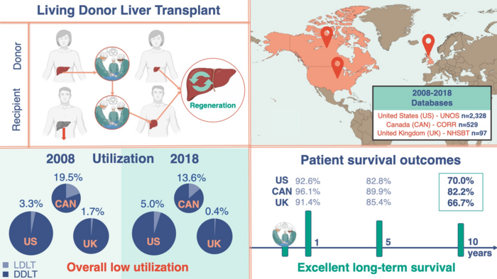 Living Donor Liver Transplantation (LDLT) in the US, Canada, and UK