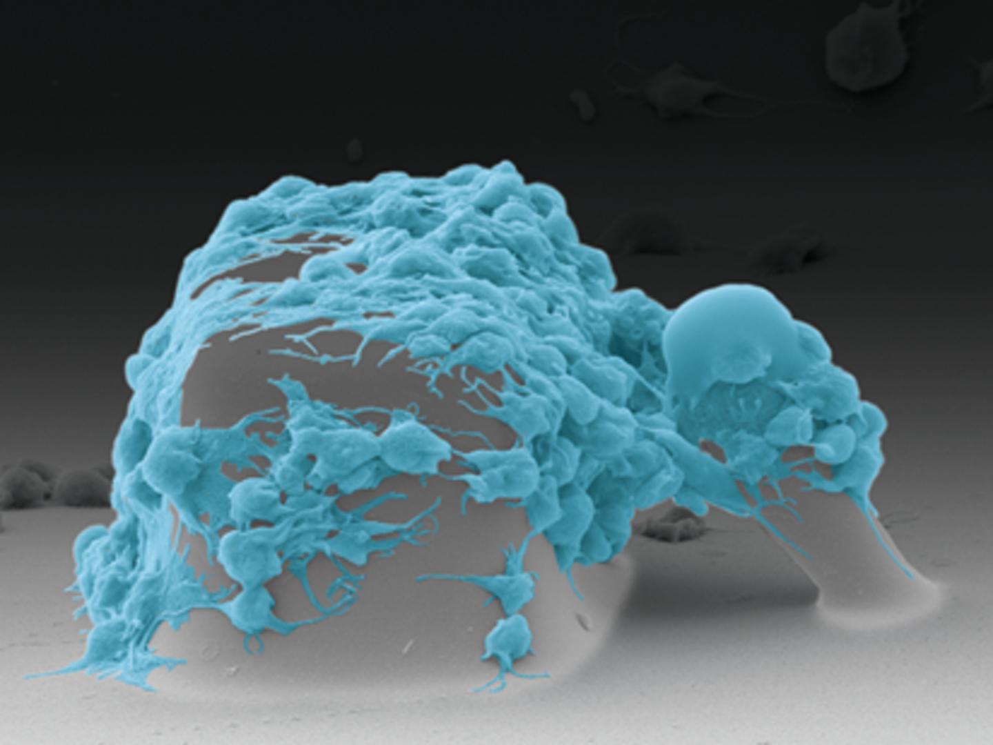 Healthy Platelets Pull The Post Toward The Block