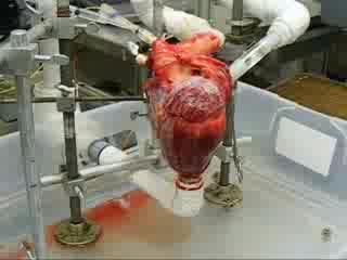 Dynamic Heart System in Action