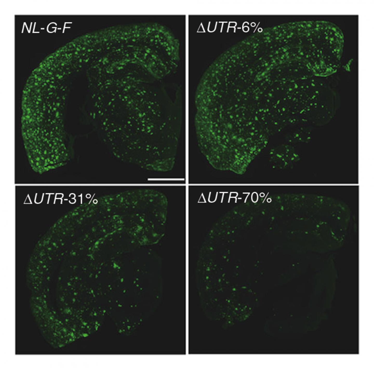 Amyloid-beta (Aβ) Pathology in the Mouse Model of Alzheimer's Disease (AD)