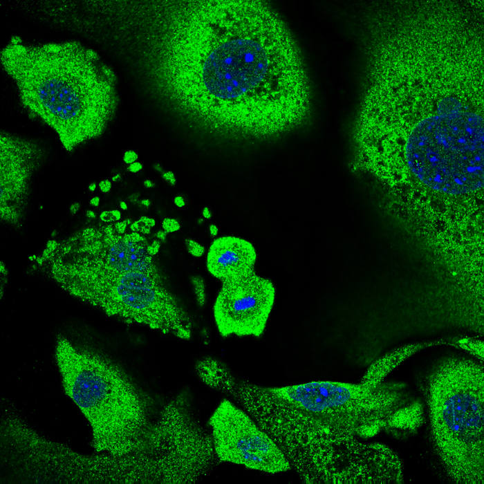 Keratinocyte undergoing cell division surrounded by senescent keratinocytes