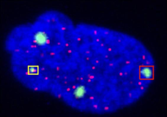 Mutations in STN1 Disrupt Telomere Function