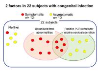 Venn Diagram Showing Ultrasound and PCR Test Findings for 22 Infants with Congenital CMV Infection