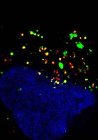 Brain Cancer Cell Ingests Extracellular Vesicles (EVs)