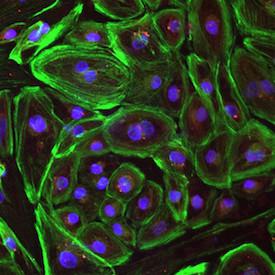 Duchenne's Cardiomyocyte Image (Green)