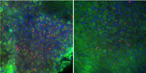 Vestibular ganglion study