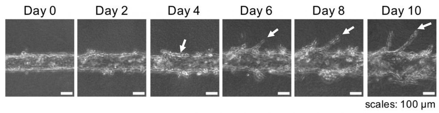 Blood Vessel-on-a-chips