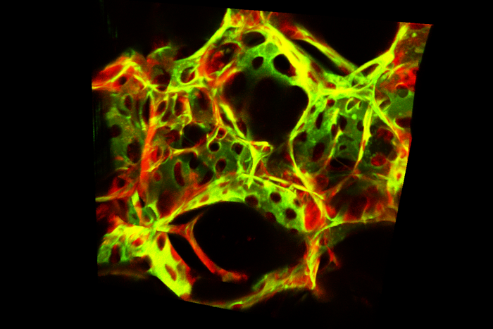 Lung endothelial cells