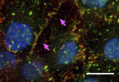 FAK Helps Cancer Metastasize