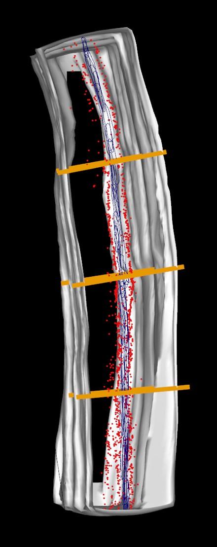 A Potential Target for Restoring Ejaculation in Men with Spinal Cord Injuries or Ejaculatory Disorders
