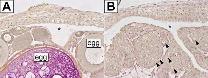 The Feminizing Effect is Inherent to Germ Cells Which are Essential for the Formation of Ovaries