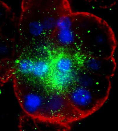 Channeling Efforts to Fight CF