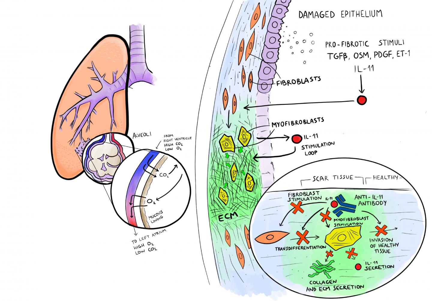 Solving the Mysterious Case of an Inflammatory Molecule's Role in Lung Fibrosis (3 of 4)