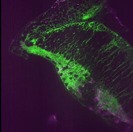 Neurons and Astrocytes