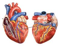 Confining the Shock to the Heart Muscle