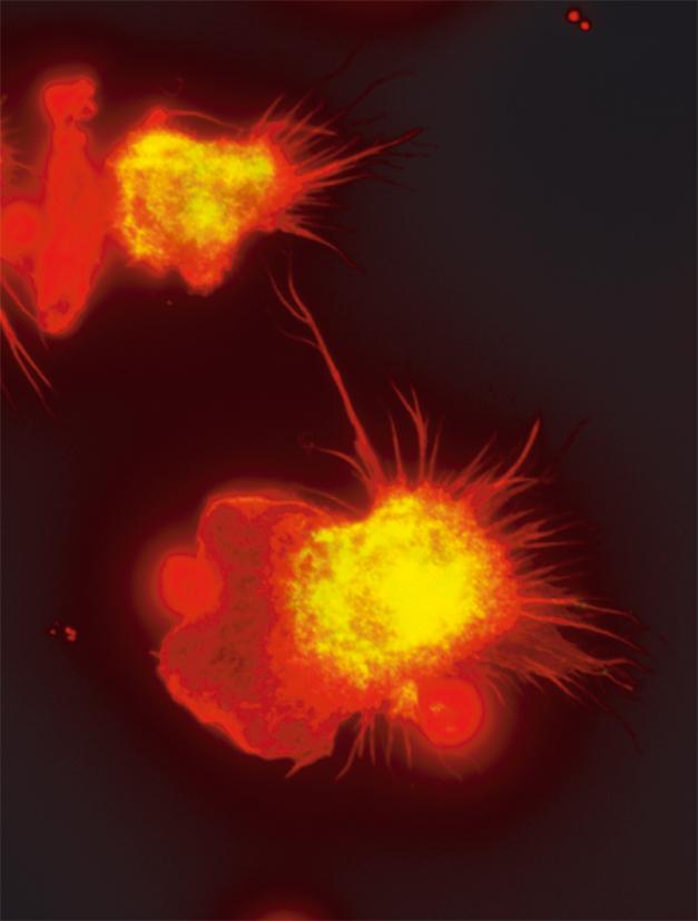 macrophages-image-eurekalert-science-news-releases