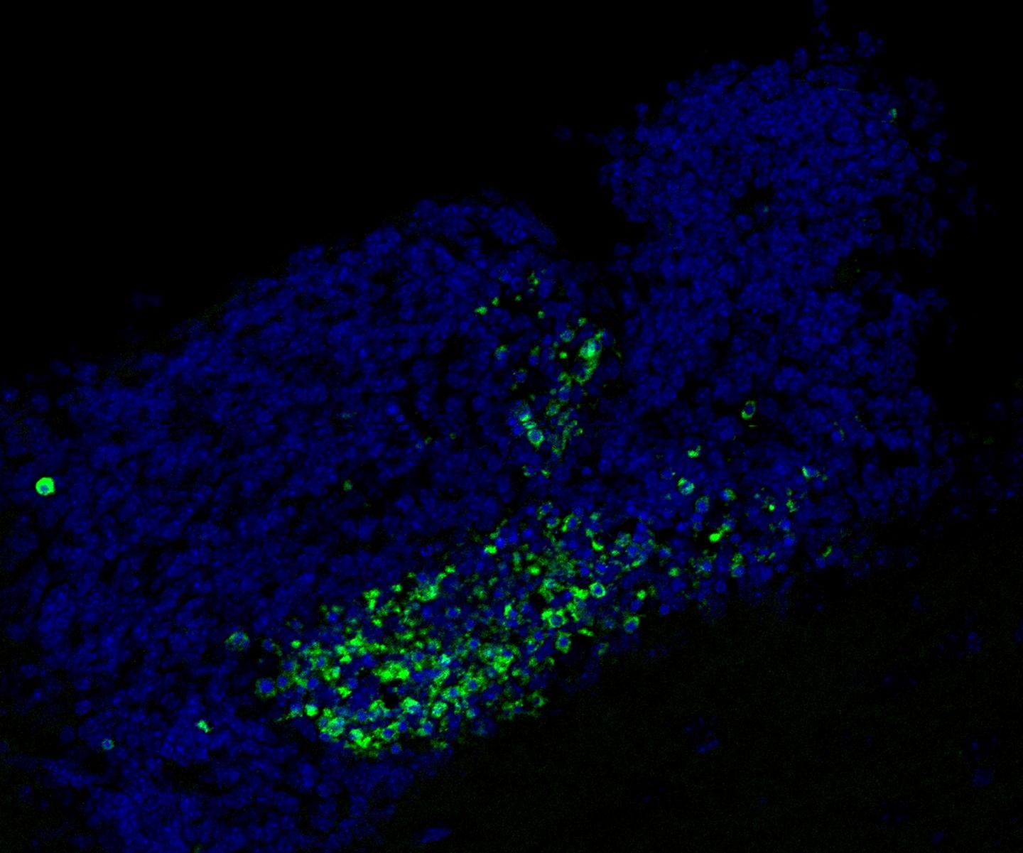 Brain Guardians Remove Dying Neurons