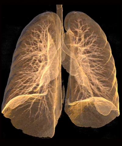 3-D Image of Lungs