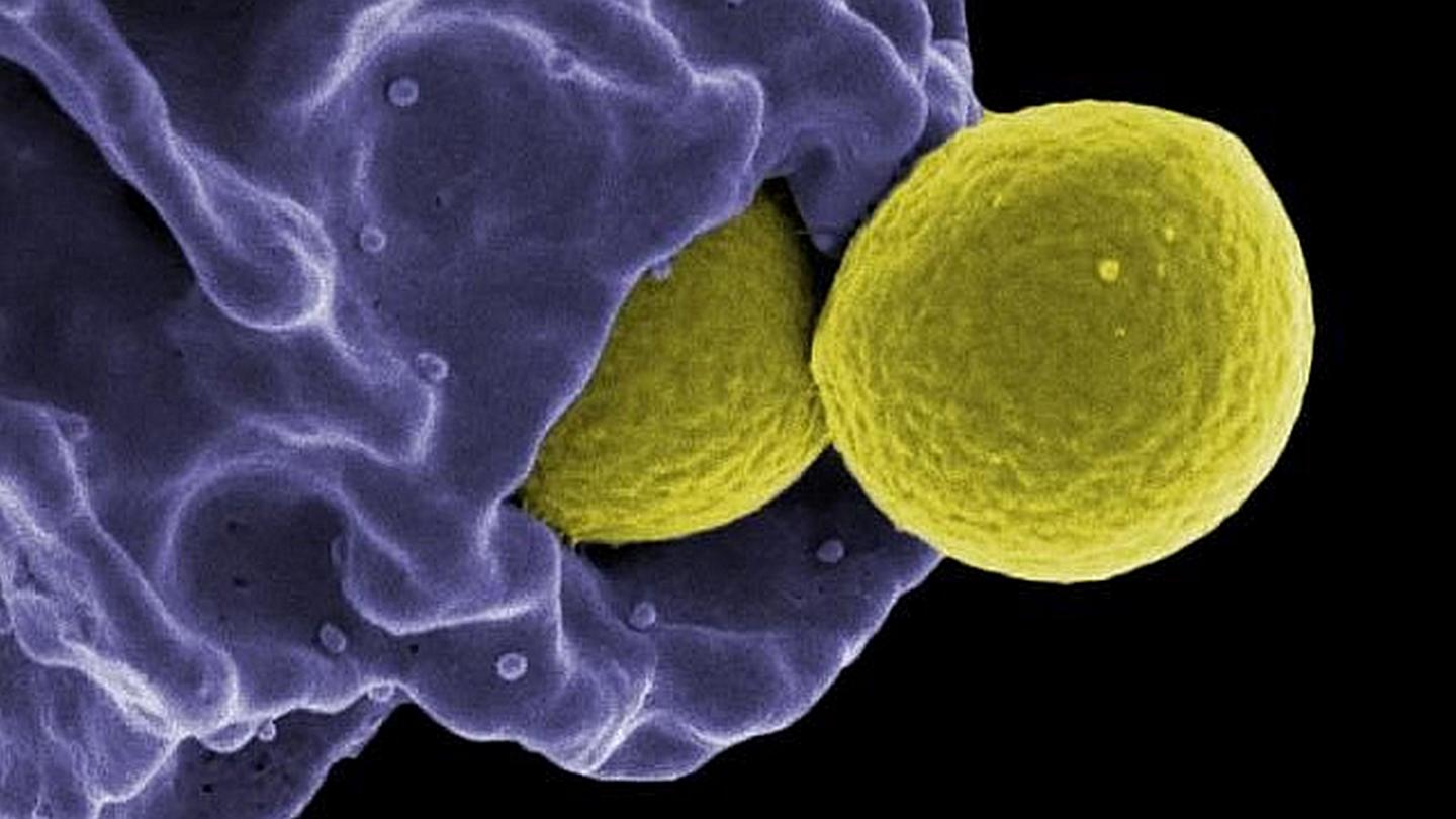 Methicillin-resistant Staphylococcus aureus