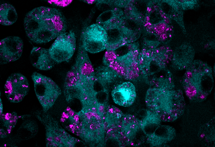 A confocal microscopy image of macrophages treated with MTX (cyan) that have eaten bacteria (magenta)