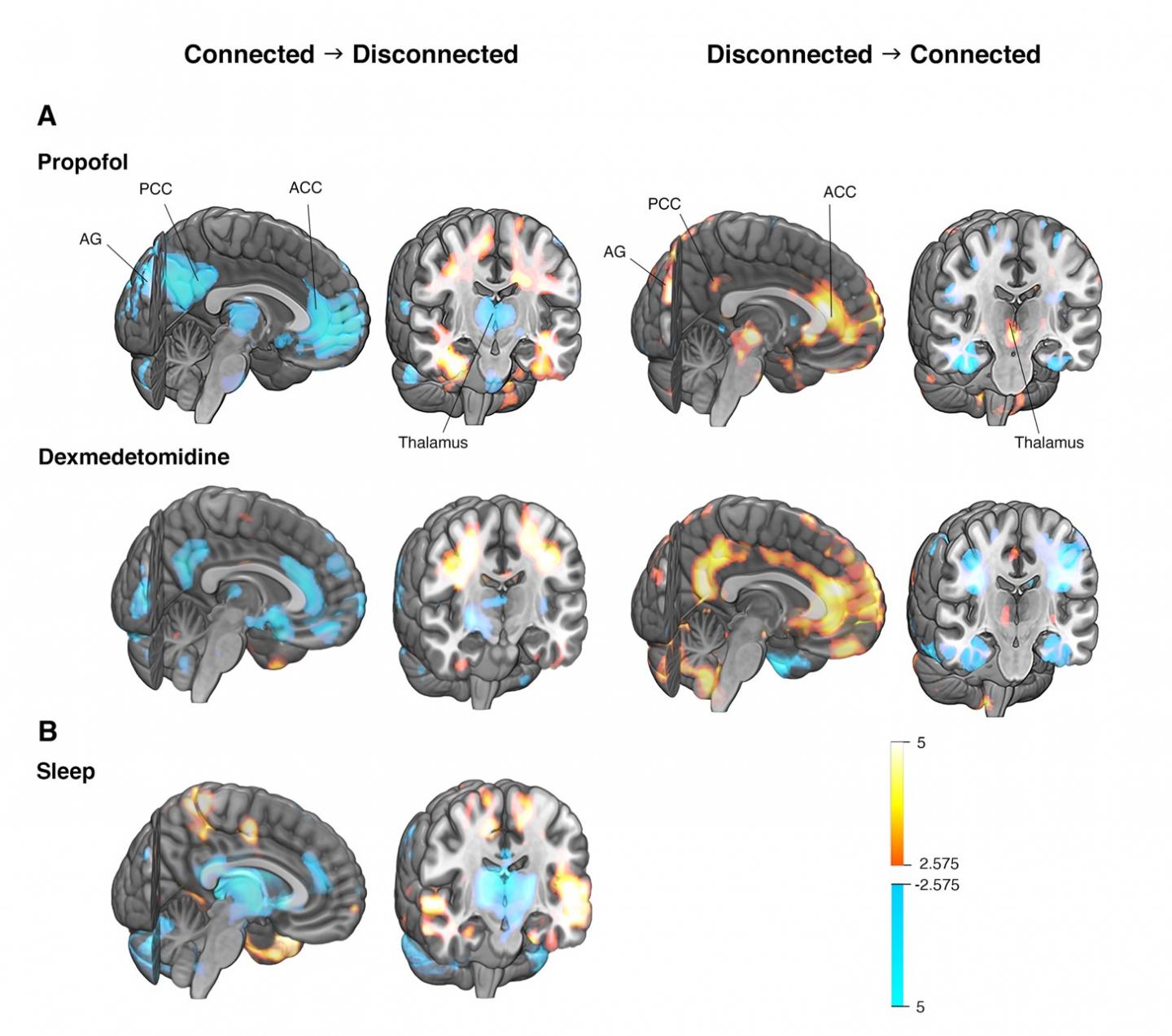 Differences in brain activity