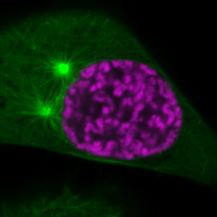 Organization of mitotic chromosomes and spindle microtubules at an early phase of cell division